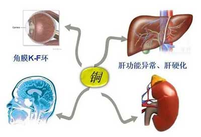 人体樱桃视频色版APP下载数据能够准检测出但身体中微量元素铜超标会引起疾病发生 人体樱桃视频色版APP下载数据能够准检测出但身体中微量元素铜超标会引起疾病发生